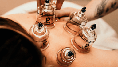 Image for Cupping Therapy
